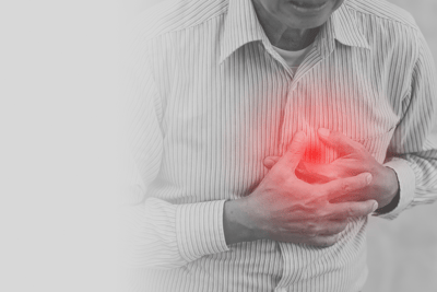 Coding Pleural Effusion in Congestive Heart Failure Patients
